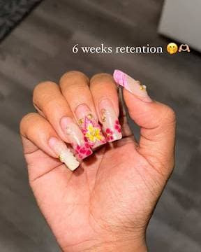 Retention image - 5